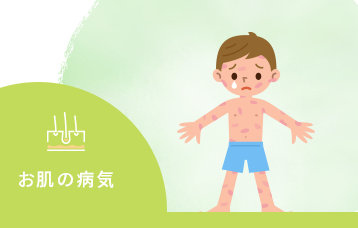 お肌の病気